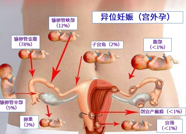 试管婴儿技术