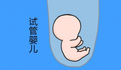 试管婴儿在什么时候取卵子和精子
