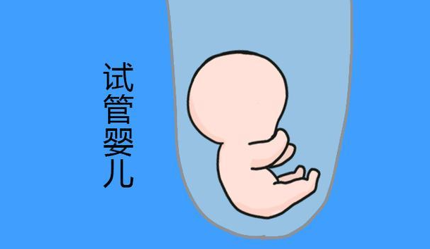 吉尔吉斯坦试管婴儿
