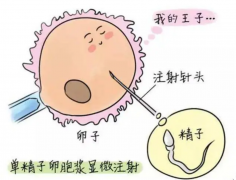 男性不孕不育能做试管婴儿吗