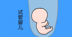 精子成活率低能做试管婴儿吗？