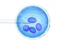 没结婚能做试管婴儿吗?吉尔吉斯斯坦试管