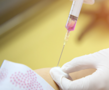 男性试管婴儿检查项目及费用